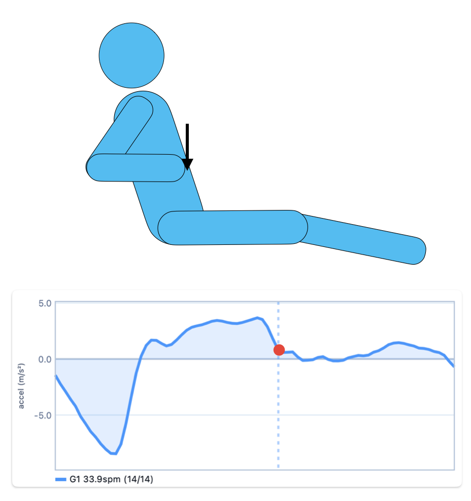 Recovery phase stroke figure and curve, panel 1